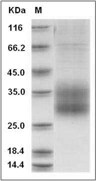 Human SCN3B Protein (His Tag) SDS-PAGE