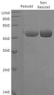 Human ST6GALNAC2/SIAT7B/SIATL1/STHM (His tag) recombinant protein