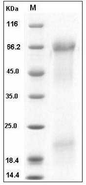 Human Osteopontin / SPP1 / ETA-1 Protein (His Tag) SDS-PAGE
