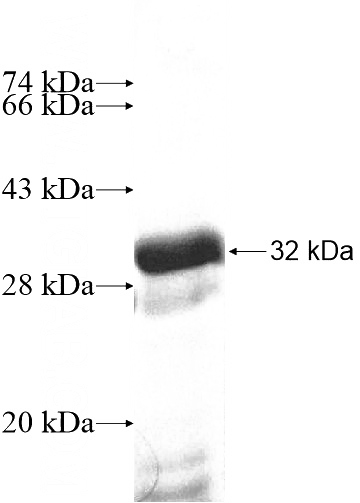 Recombinant Human GPR176 SDS-PAGE