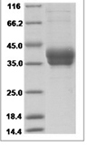 Human KDR recombinant protein (C-His)