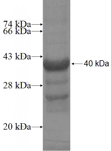 Recombinant Human DHX29 SDS-PAGE