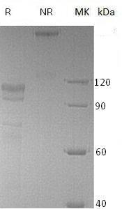Human EPHB2/DRT/EPHT3/EPTH3/ERK (Fc tag) recombinant protein