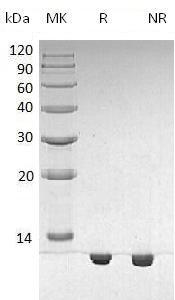 Human S100B (His tag) recombinant protein