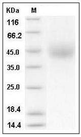 Human IL10Rb Protein (His Tag) SDS-PAGE