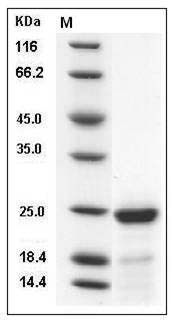 Mouse FGF21 / Fibroblast Growth Factor 21 Protein (His Tag) SDS-PAGE