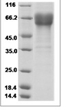 Human TMIGD1 Protein 14767