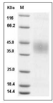 Mouse Epcr / PROCR Protein (His Tag) SDS-PAGE