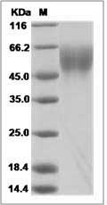 Ebola virus EBOV (subtype Zaire, strain Mayinga 1976) GP-RBD / Glycoprotein Protein