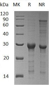 Human STAT6 (His tag) recombinant protein