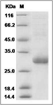 Human TMED1 Protein (His Tag) SDS-PAGE