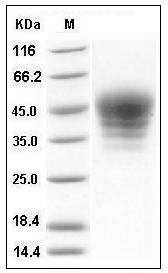 Mouse SLAMF7 / CRACC Protein (His Tag) SDS-PAGE