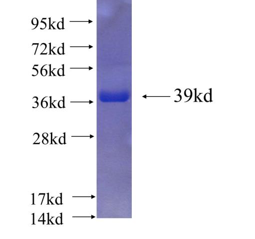 Recombinant human NMT1 SDS-PAGE