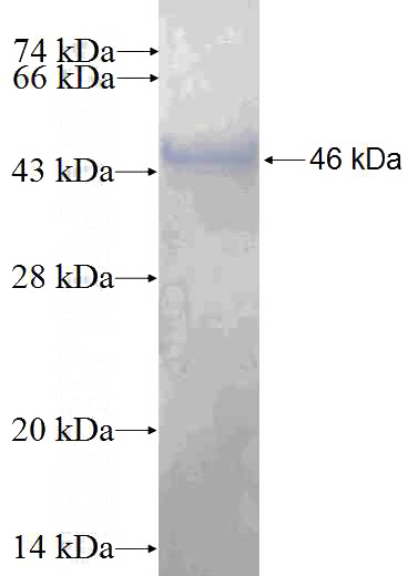 Recombinant Human PPP3R2 SDS-PAGE