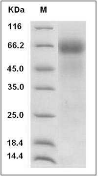Rat FGFR4 / FGF Receptor 4 Protein (His Tag) SDS-PAGE