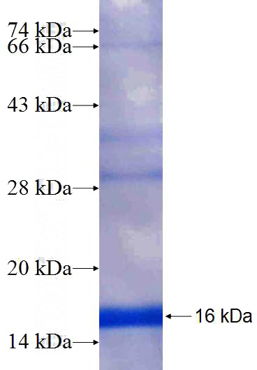 Recombinant Human CH25H SDS-PAGE
