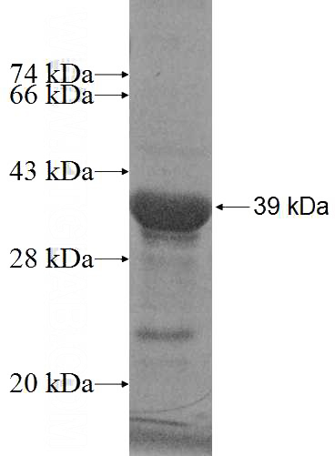 Recombinant Human ARNTL SDS-PAGE
