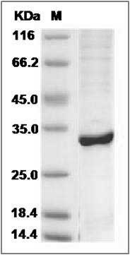 Human ABHD10 Protein (aa 53-306, His Tag) SDS-PAGE
