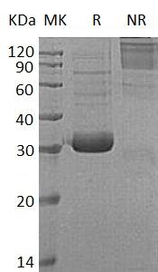 Human COLEC11/UNQ596/PRO1182 (His tag) recombinant protein