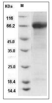 Influenza A H6N4 (A/chicken/HongKong/17/77) Hemagglutinin / HA Protein (His Tag) SDS-PAGE