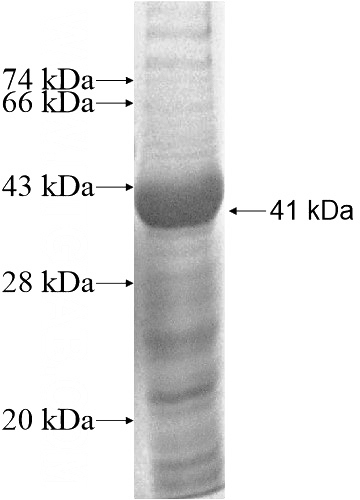 Recombinant Human TTLL4 SDS-PAGE