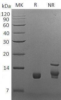 S.cerevisiae PAM16/TIM16/YJL104W/J0822 recombinant protein