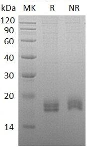 Human CCL24/MPIF2/SCYA24 (His tag) recombinant protein