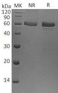 Human SMAD2/MADH2/MADR2 (His & Flag tag) recombinant protein