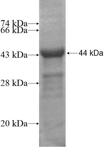 Recombinant Human CCDC120 SDS-PAGE