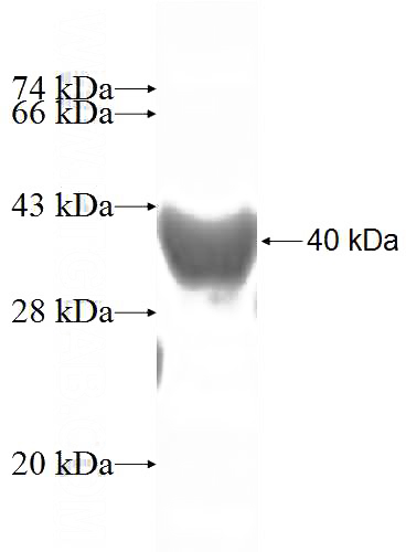 Recombinant Human NTHL1 SDS-PAGE