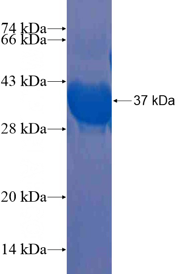 Recombinant Human CCDC123 SDS-PAGE