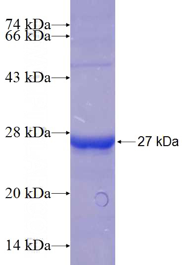 Recombinant Human RRP7A SDS-PAGE