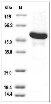 Human GBA3 / CBGL1 Protein (His Tag) SDS-PAGE