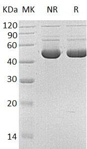 Human HMBS/PBGD/UPS (His tag) recombinant protein