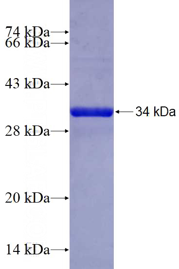 Recombinant Human RPS13 SDS-PAGE