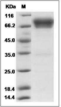 Human B7-H4 / B7S1 / B7x Protein (Fc Tag) SDS-PAGE