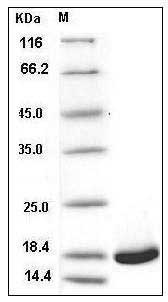 Human VAPB / VAMP-associated protein B/C Protein (His Tag) SDS-PAGE