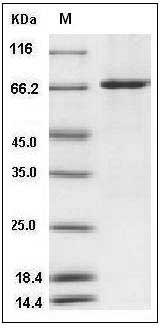 Human KIT / c-KIT / CD117 Protein (aa 540-972, His & GST Tag) SDS-PAGE