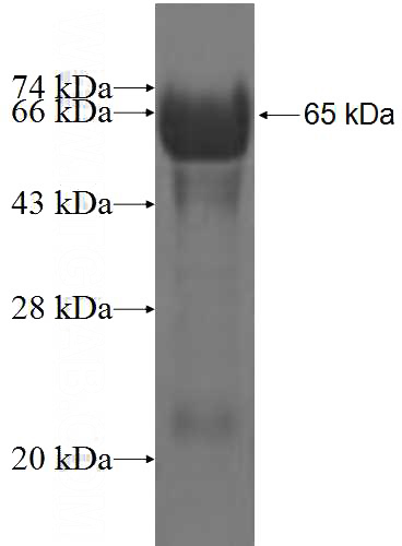 Recombinant Human TACC1 SDS-PAGE