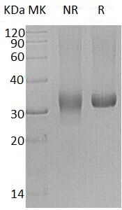 Human PRG2/MBP (His tag) recombinant protein