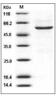 Human CDK4 / CMM3 Protein (GST Tag) SDS-PAGE