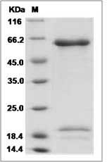 Human PCSK9 / NARC1 Protein (His Tag)