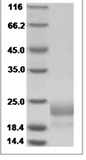 Human CTLA-4/CD152 Protein 14114