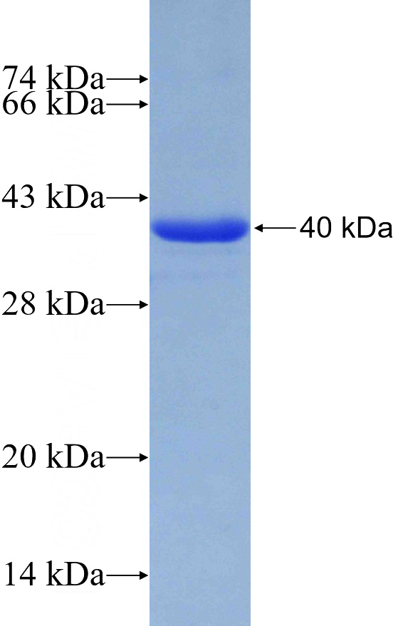 Recombinant Human ACE2 SDS-PAGE