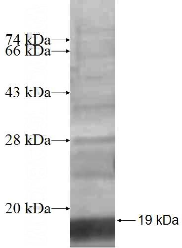 Recombinant Human RPL34 SDS-PAGE