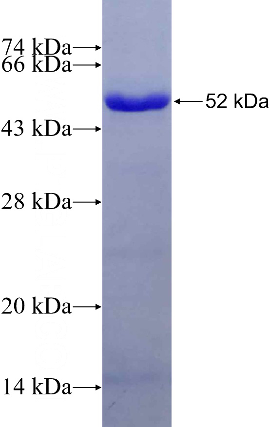 Recombinant Human ARHGEF16 SDS-PAGE