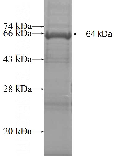 Recombinant Human CCDC110 SDS-PAGE