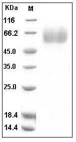 Human MSR1 / SCARA1 / CD204 Protein (His Tag) SDS-PAGE