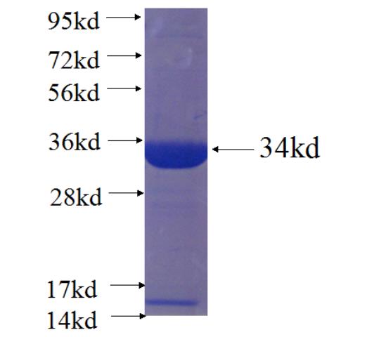 Recombinant human FYCO1 SDS-PAGE