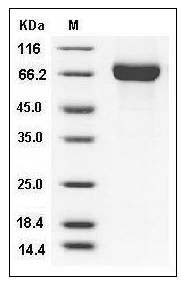 Influenza A H9N2 (A/Guinea fowl/Hong Kong/WF10/99) Hemagglutinin / HA Protein (His Tag) SDS-PAGE